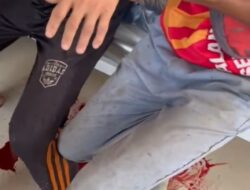 Sengketa Lahan Antara PT. Marketindo Selaras dan Masyarakat Berujung Pembacokan, 2 Warga Desa Lamoean Terluka Parah